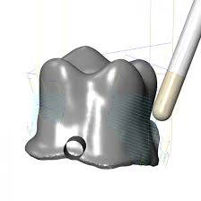 Advances in Technology for Dental Manufacturing