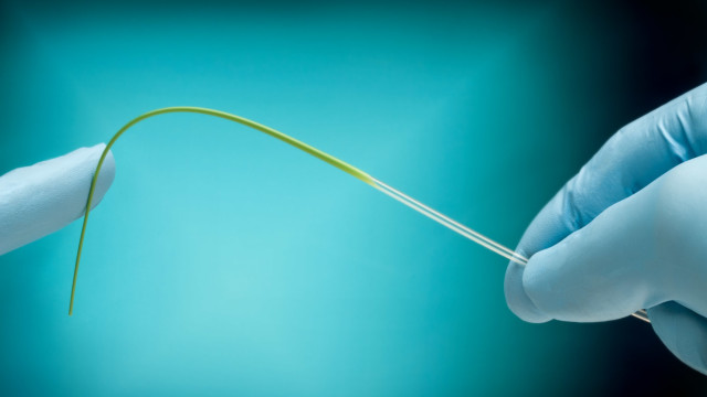 PUTNAM PLASTICS NEW TAPER-TIE™ TECHNOLOGY OPTIMIZES VARIABLE FLEXIBLITY OF MEDICAL CATHETER SHAFTS