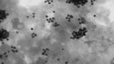 Polymer nanoparticles track down cancer cells